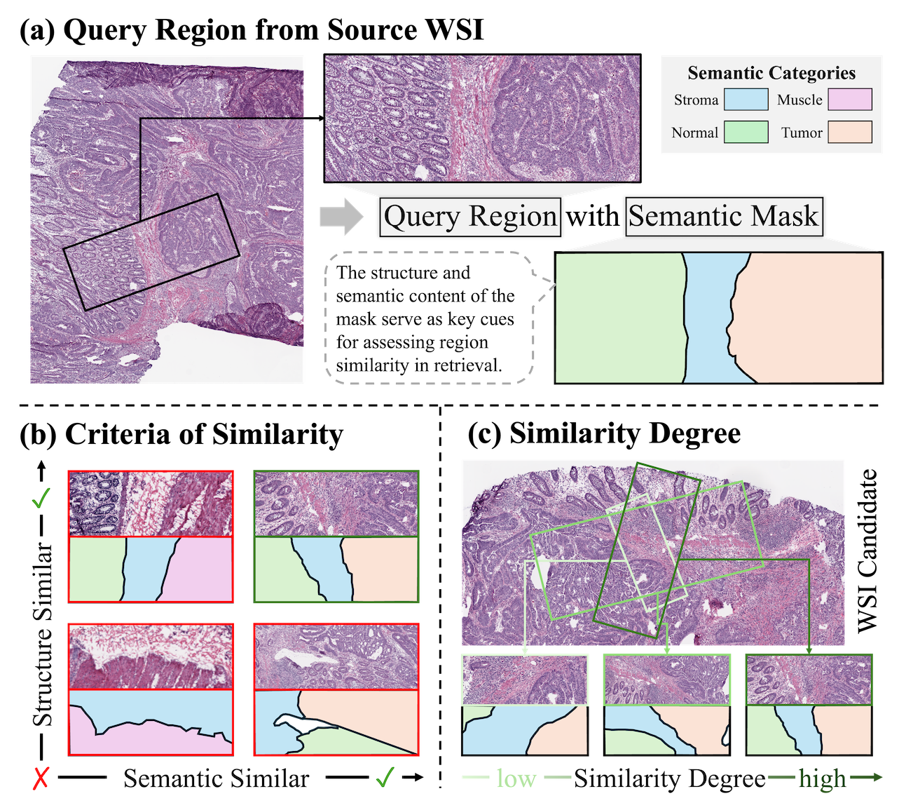 WSI region retrieval challenge: patch methods lack spatial context, slide methods lose fine-grained morphology